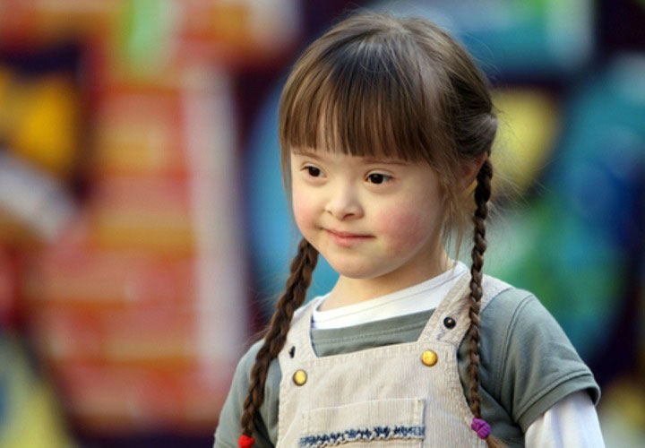 پرورش کودک استثنایی